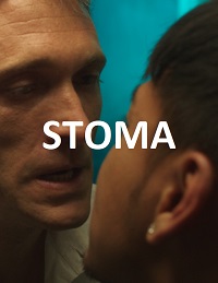 Stoma